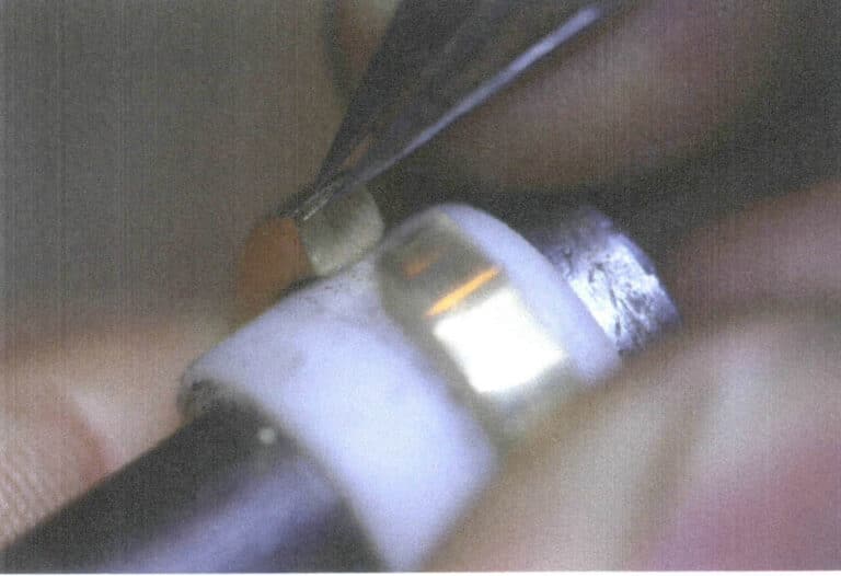 Figura 7-10 Marcação da posição da ranhura