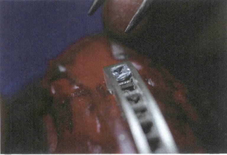 Figura 8-9 A gema é inserida na ranhura de um dos lados.