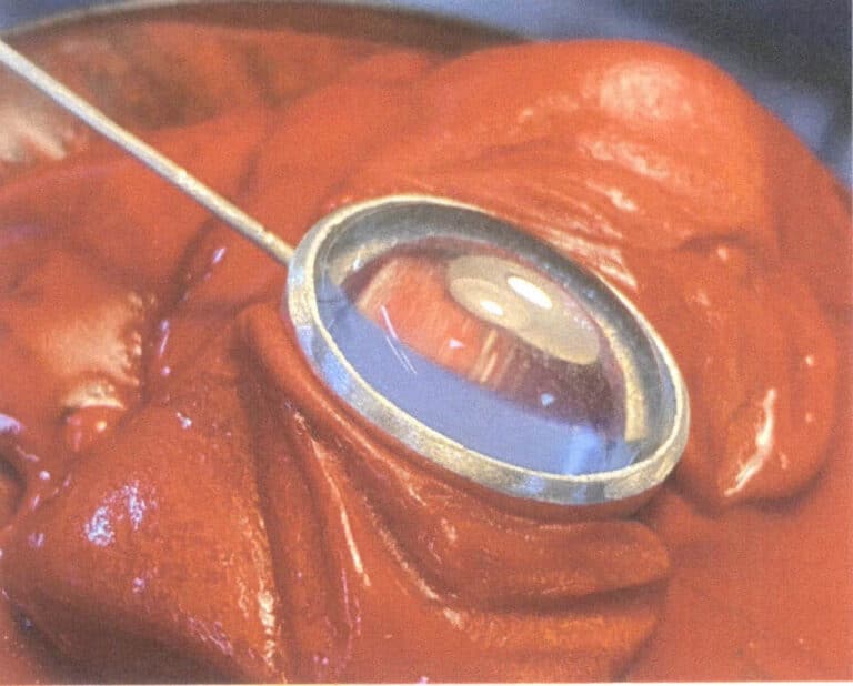 Figure 2-25 Placing the Stone