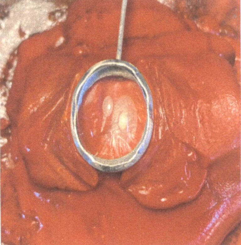 Figure 2-29 Symmetrical point fixation (eight points)