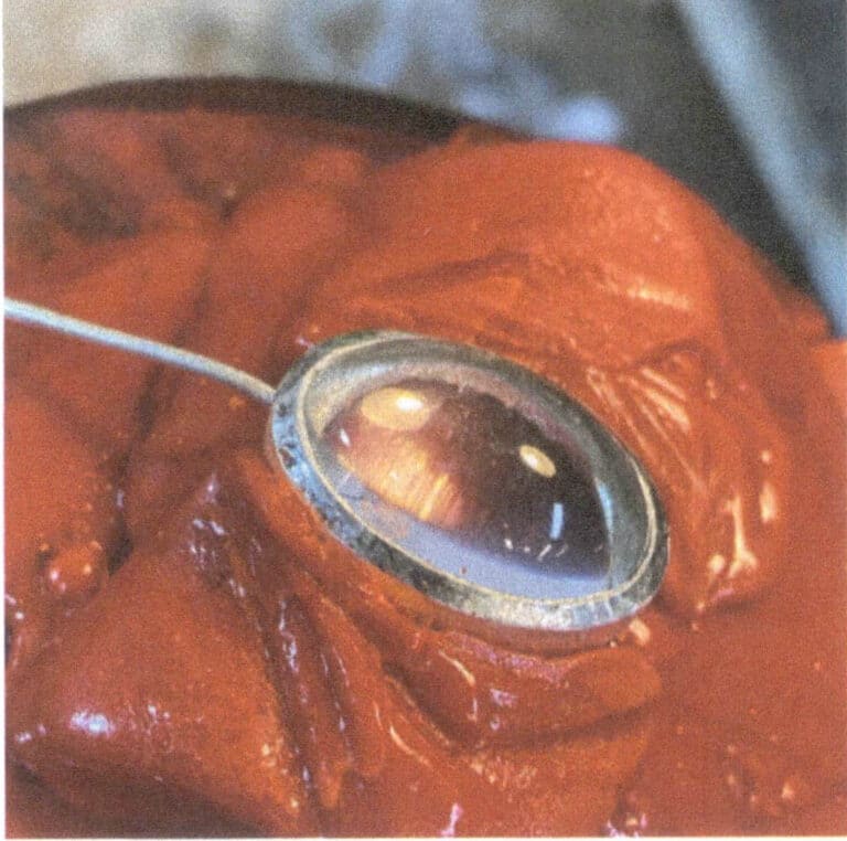 Figure 2-30 Cyclic Edge Pressing