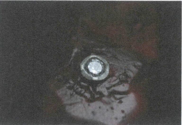 Figure 2-61 Spot Fixing