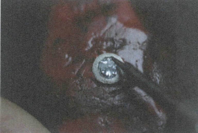 Figure 2-63 Repairing the Inner Side of the Metal Edge with a Pusher