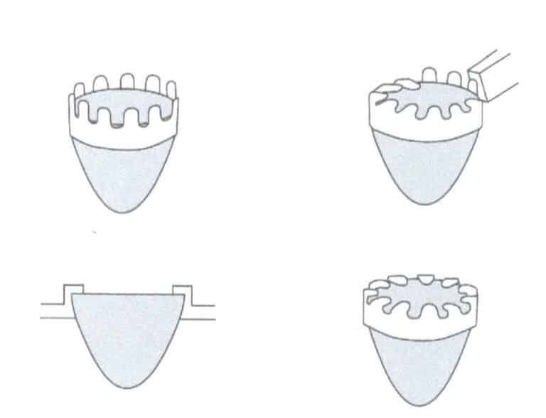 Figure 2-86 reverse-tapered bezel setting structure