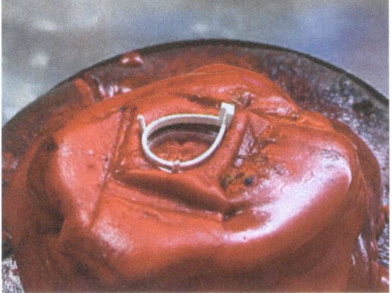 3-4. ábra Pecsétviasz felvitele