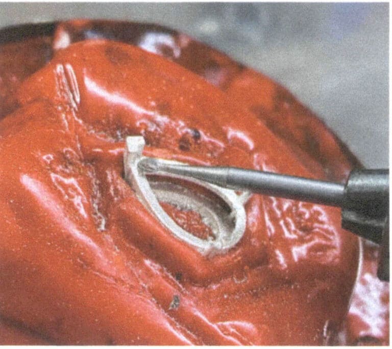 3-6. ábra A csepp alakú kőfoglalat éles sarkának csiszolása barackos csiszolóval