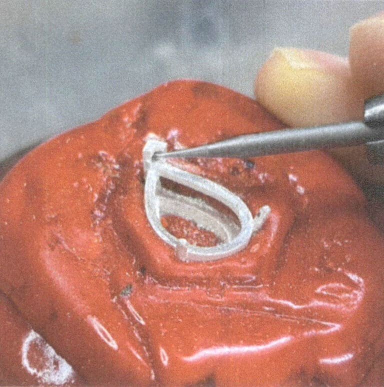 3-9. ábra A sarokcsap kőbeillesztési pozíciójának megnyitása a saroknál egy gömbfúróval