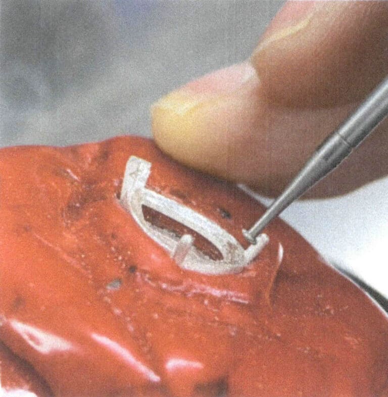 3-11. ábra Tárcsás fúró a nyitókő beállítási pozíciójához a füles fogókban