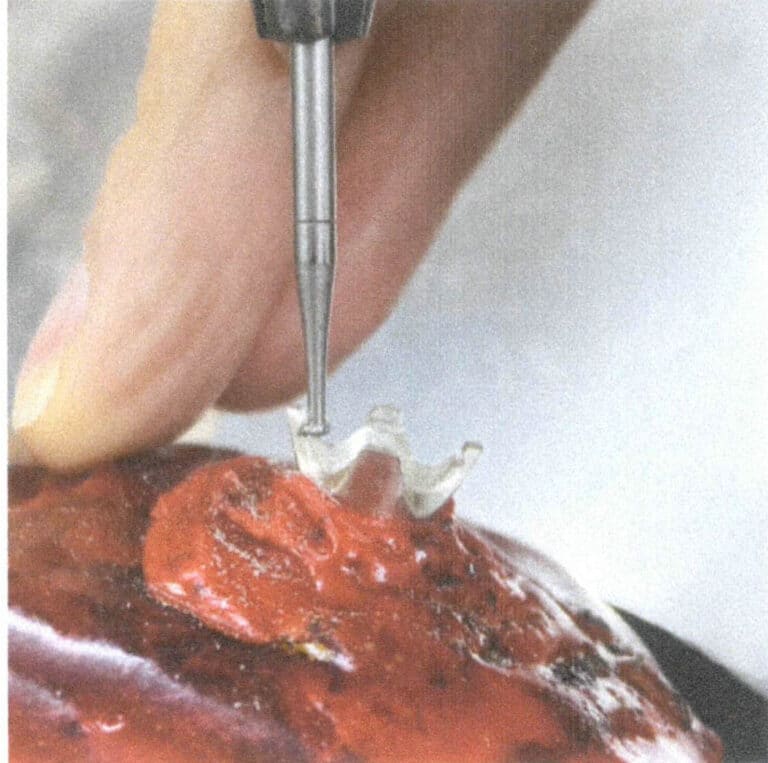 3-43. ábra A kőbeállító pozíció kinyitása