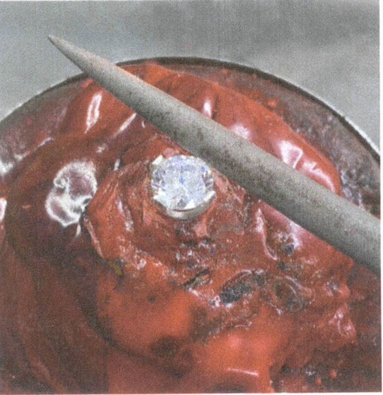 3-46. ábra Fémfogak reszelése