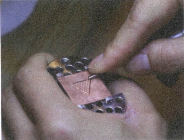 5-30 ábra Szélvonal kaparása