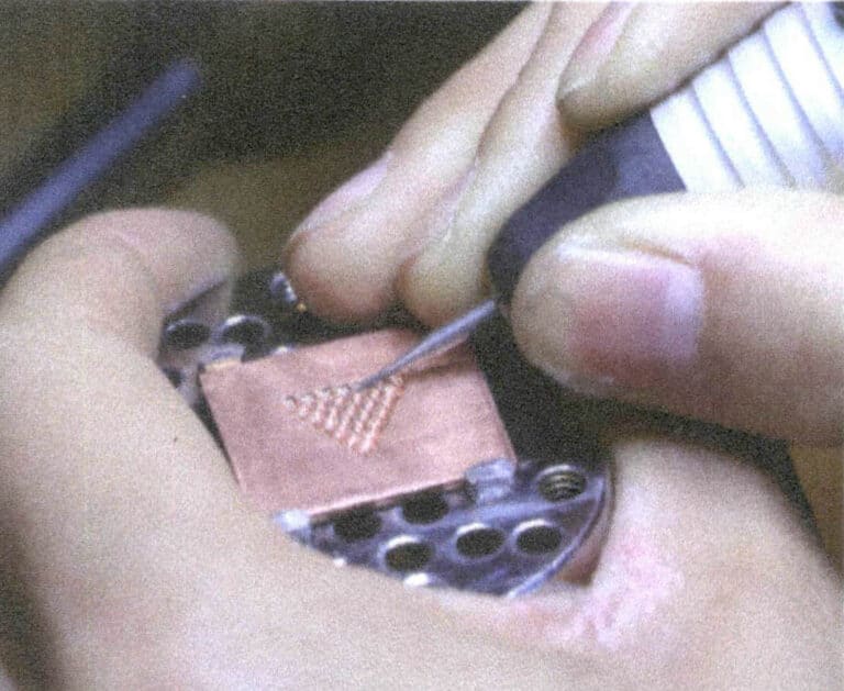 5-36. ábra Fogak Tűs hornyolás (1)