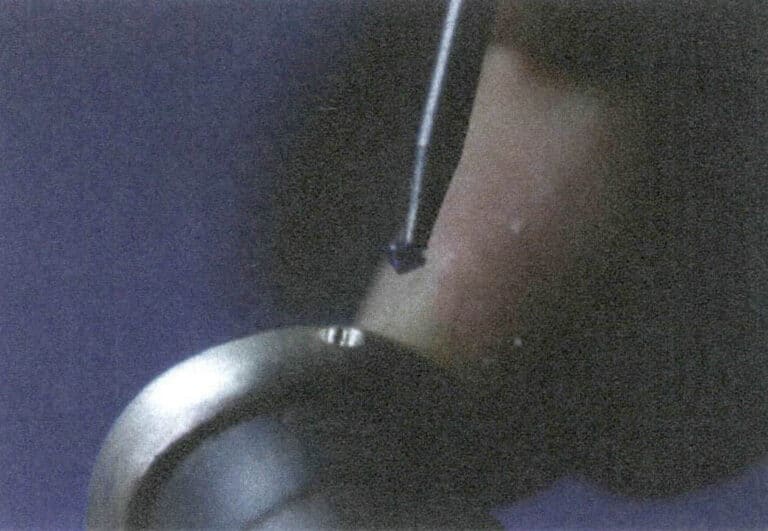 Figura 6-12 Colocação da pedra