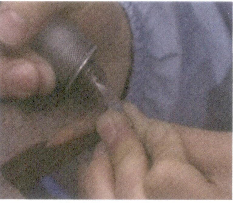 Figura 6-14 Fosse di sabbia da macinare