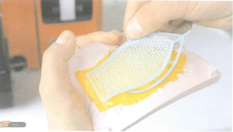 Figure 3-18 Removing the wax mold