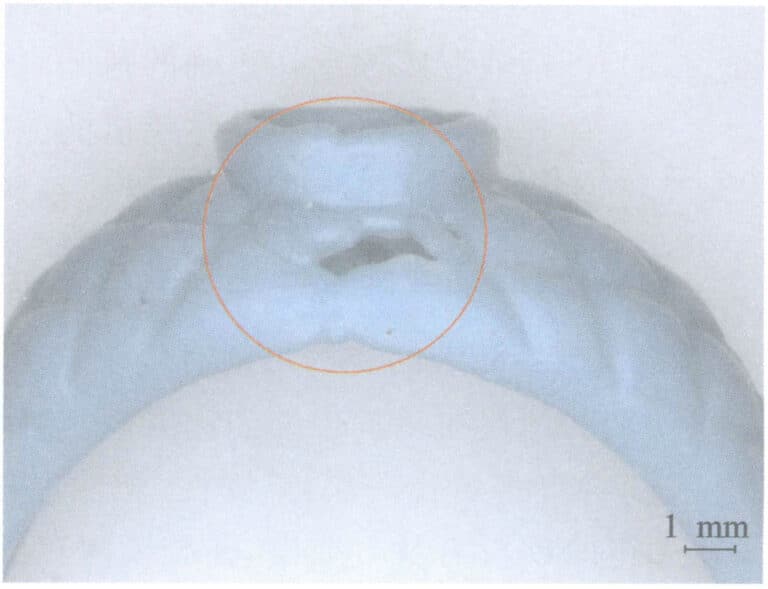 Figure 3-43 Defective wax mold