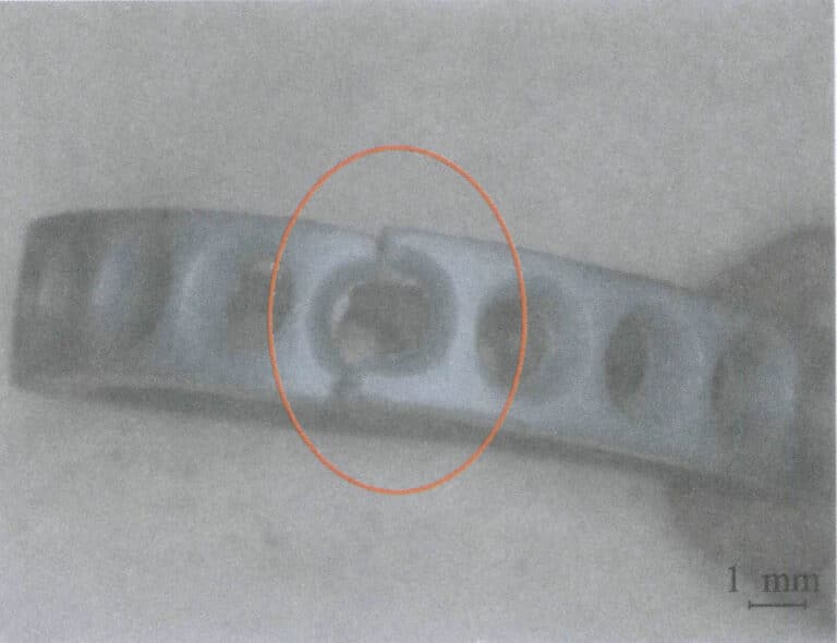 Figure 3-45 Wax mold fracture
