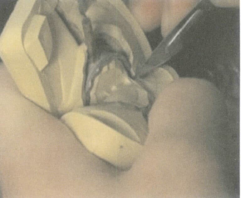 Figure 2-20 Positioning the four corners of the silicone mold