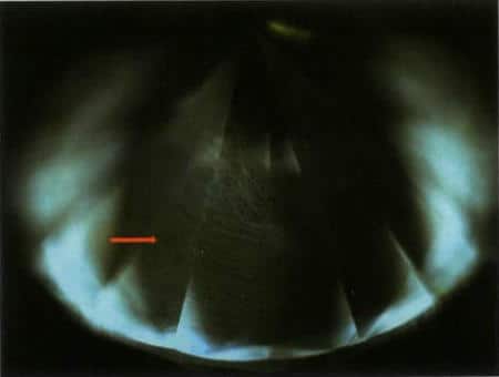 Figure 3-15 Fluorescence and layered growth textures of CVD synthetic diamonds under Diamond ViewTM